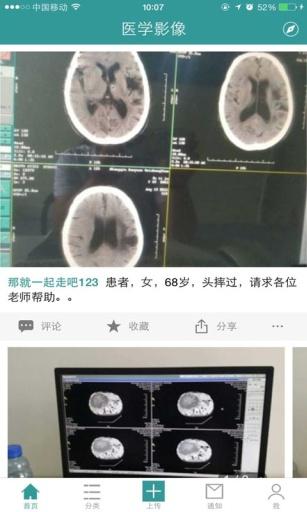 醫學影像