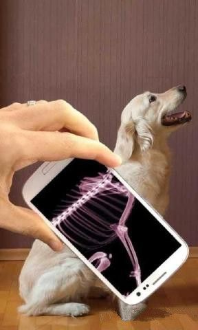 人体射线扫描
