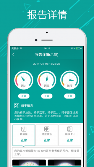 微查孕簡(jiǎn)