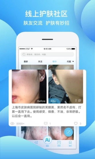 皮膚寶