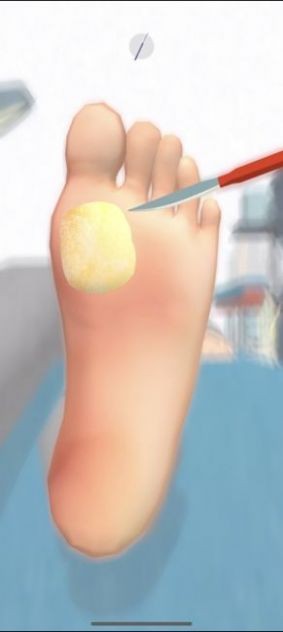 你腳真的有毒