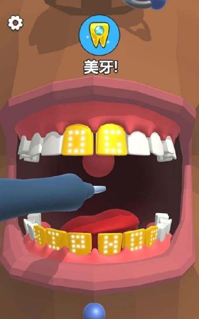 洗牙游戲