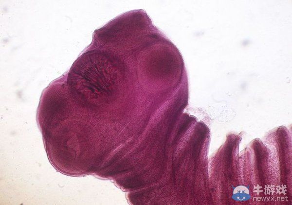 畫面太“美”我不敢看！盤點(diǎn)食物中帶有的10種寄生蟲