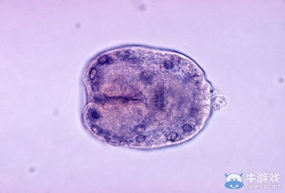 畫面太“美”我不敢看！盤點(diǎn)食物中帶有的10種寄生蟲