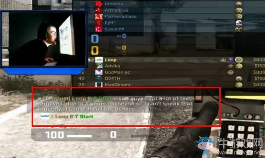 《CS:GO》殘疾主播被惡語相向 玩家發帖號召更多愛